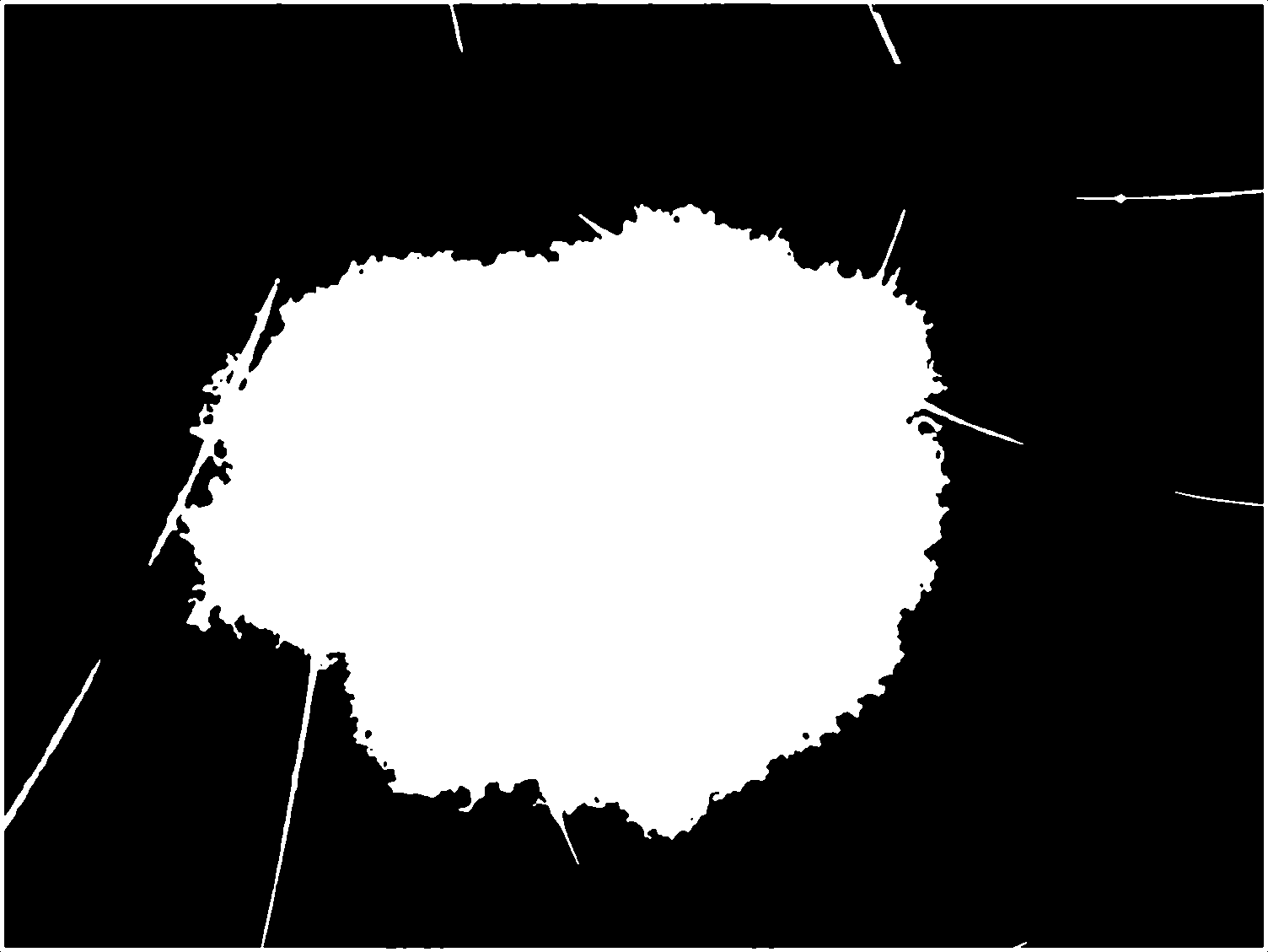 Máscara de segmentação dermatoscópica